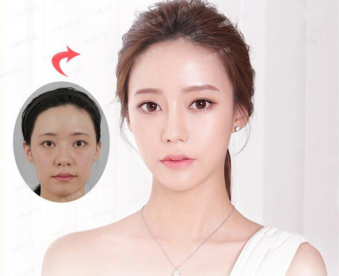 韩国整容后都能这么美吗?美的太不可思议了! – id整形医院